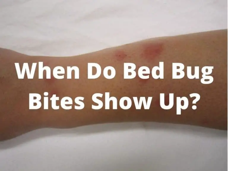 This Is Why Bed Bug Bites Can Show Up Weeks After Incident
