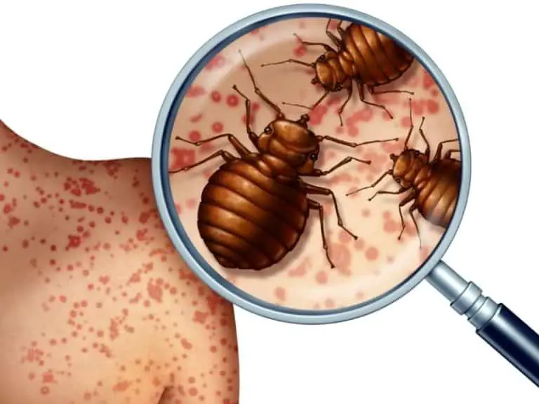How To Tell the Difference Between a Bed Bug and a Chigger Bites?